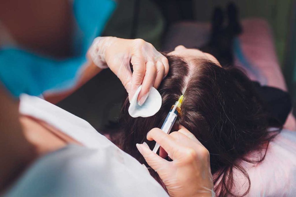 Platelet-rich plasma injection procedure. Hair growth stimulation. PRP therapy process