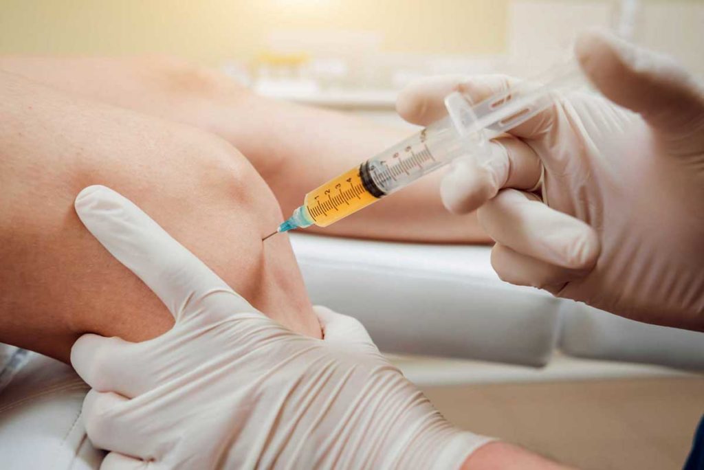 Platelet-rich plasma injection of the knee in hospital